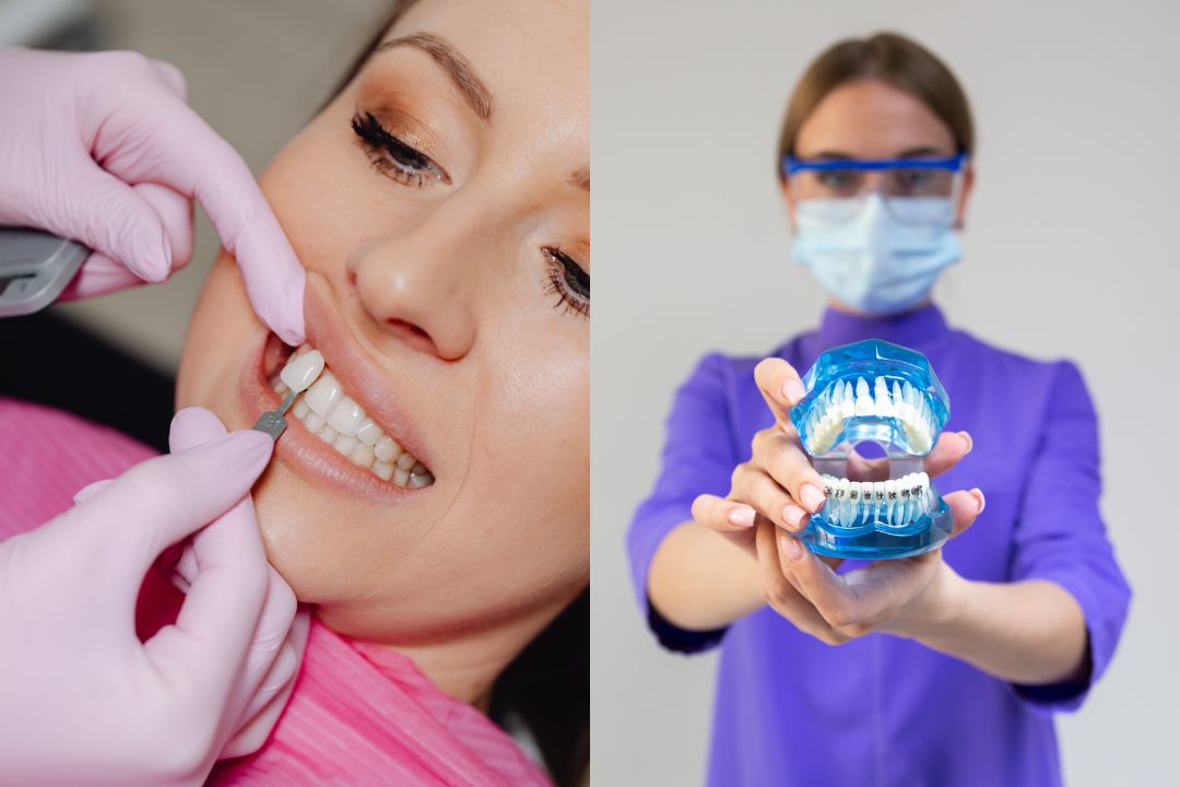 Porcelain Veneers vs Composite Bonding